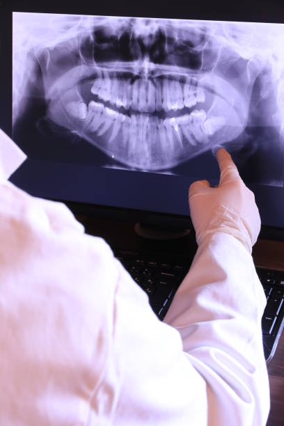 Best Emergency Root Canal Therapy in Honey Grove, TX